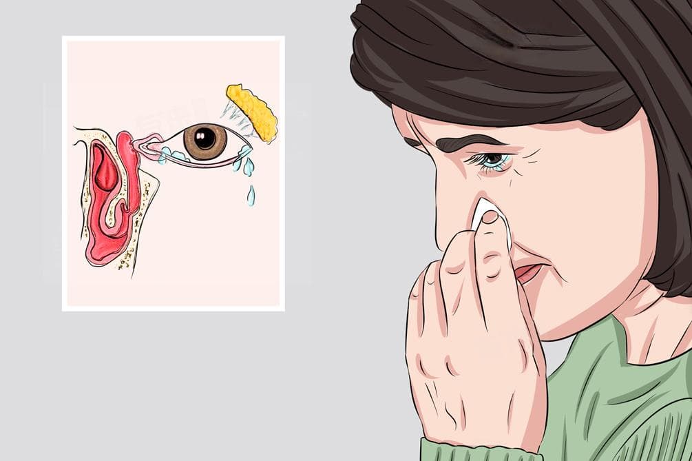 打哈欠为什么流眼泪