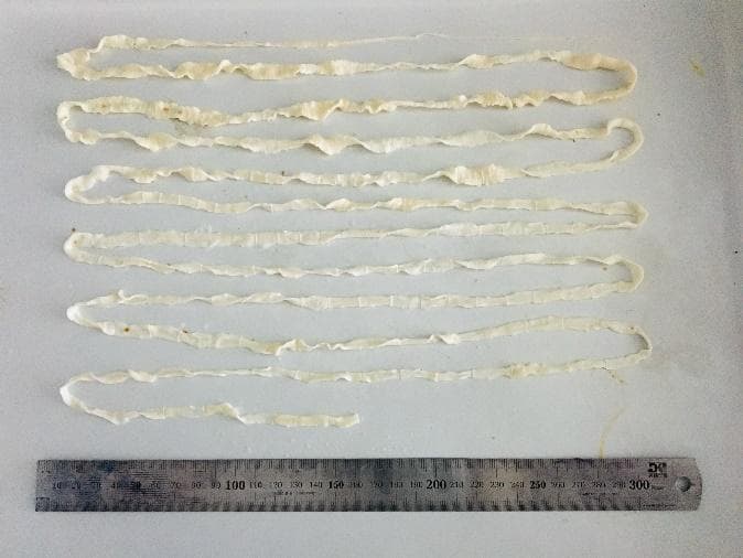 吃了这种肉，有人体内长出4米长的虫子？预防方法