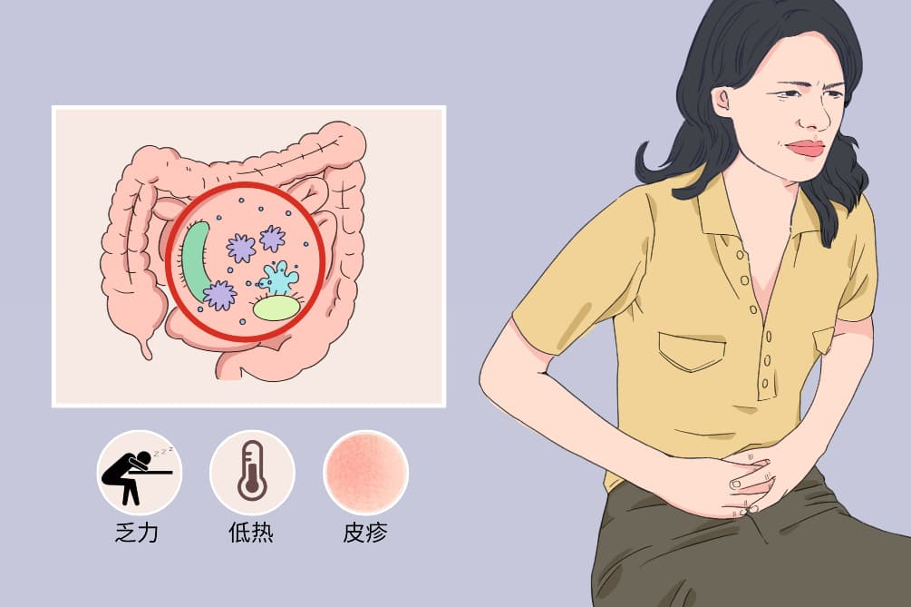 肠道病毒感染