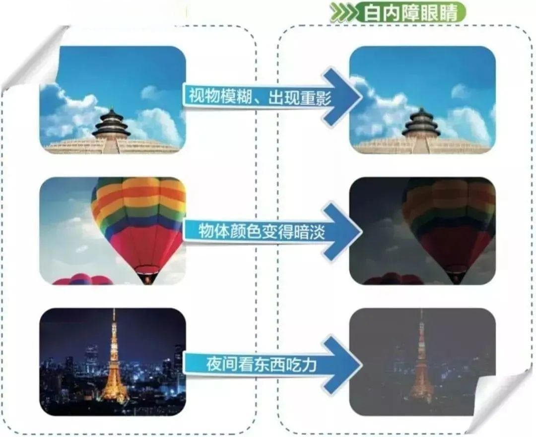 年轻时受点近视的苦，老了就有福？医生：突然看清要警惕这种眼病