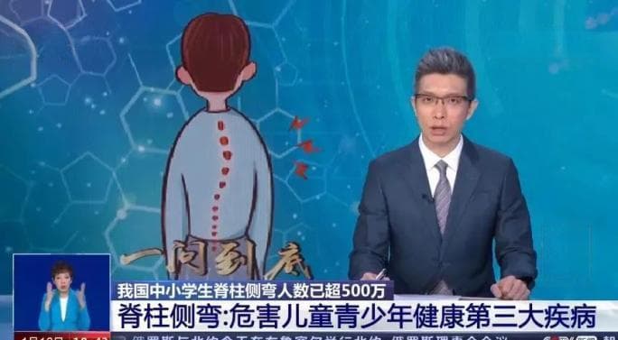 翘腿、歪坐要不得，7个动作教你预防脊柱侧弯