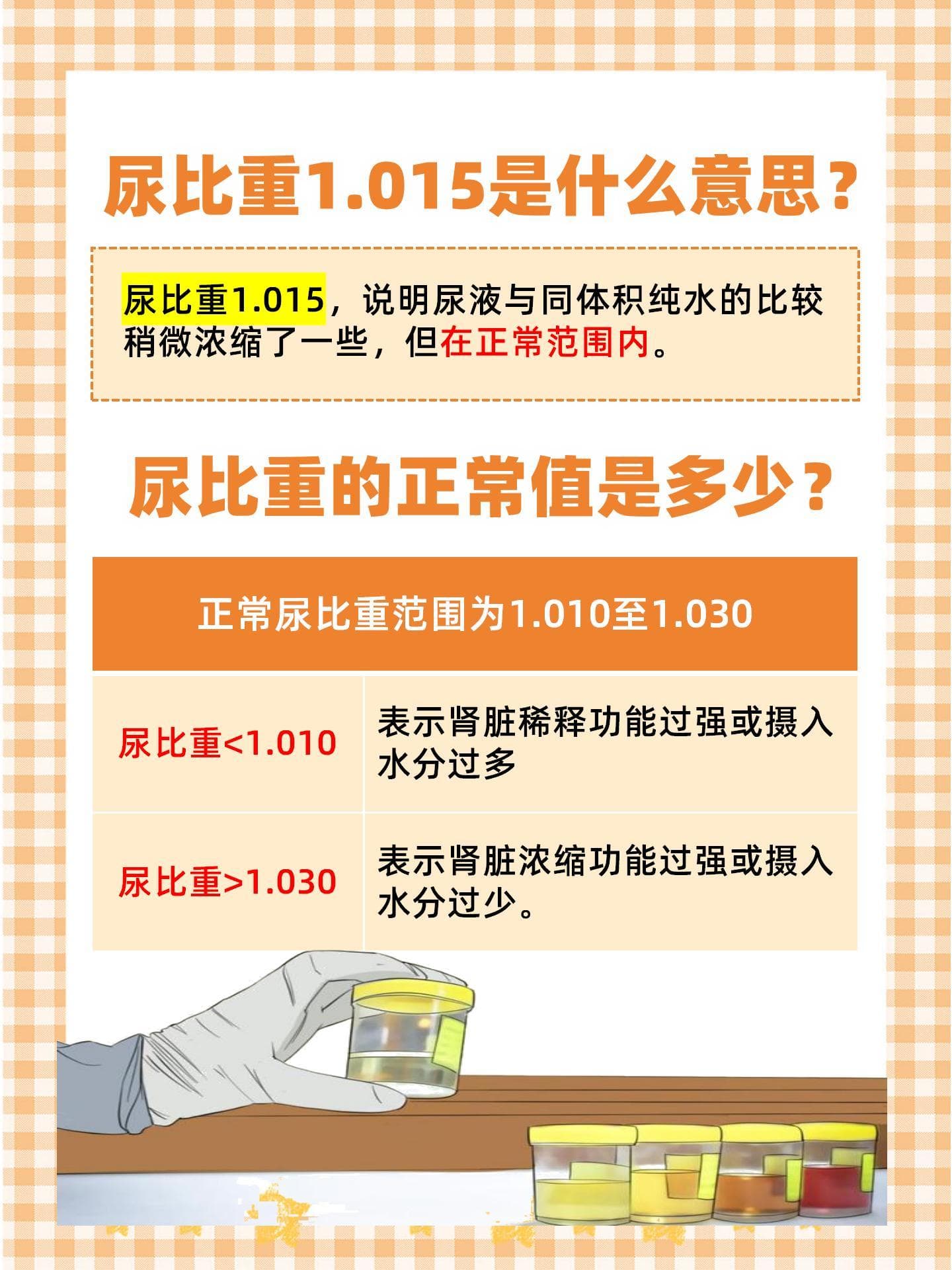 尿比重解读：你的健康信号
