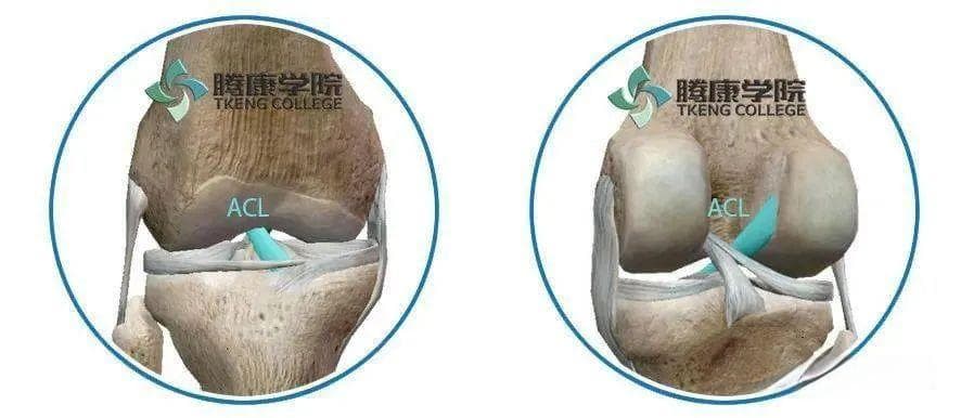 步态分析与前交叉韧带损伤的解剖、症状、机制及治疗
