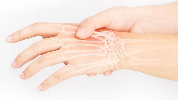 如何恢复手指变形？三种实用解决方案