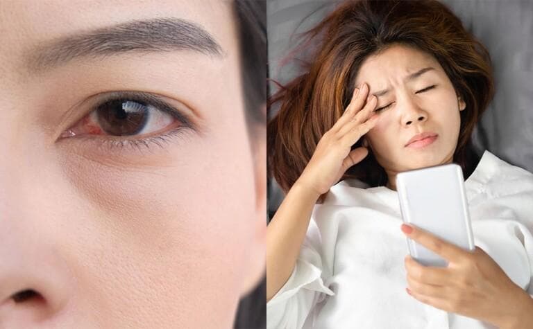 睫毛增长液的正确使用方法和注意事项