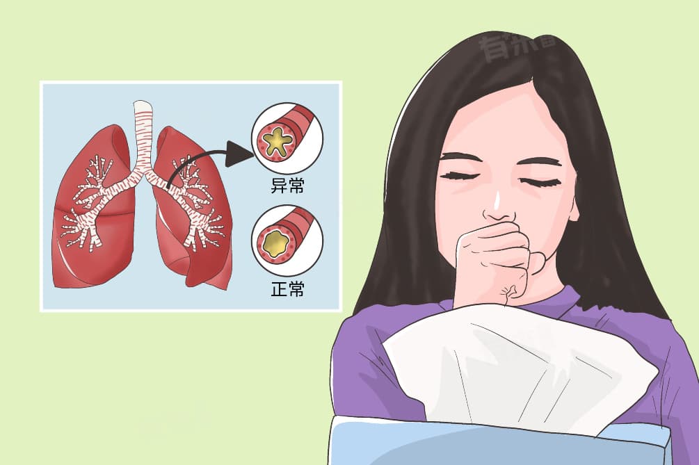 慢性支气管炎主要病因