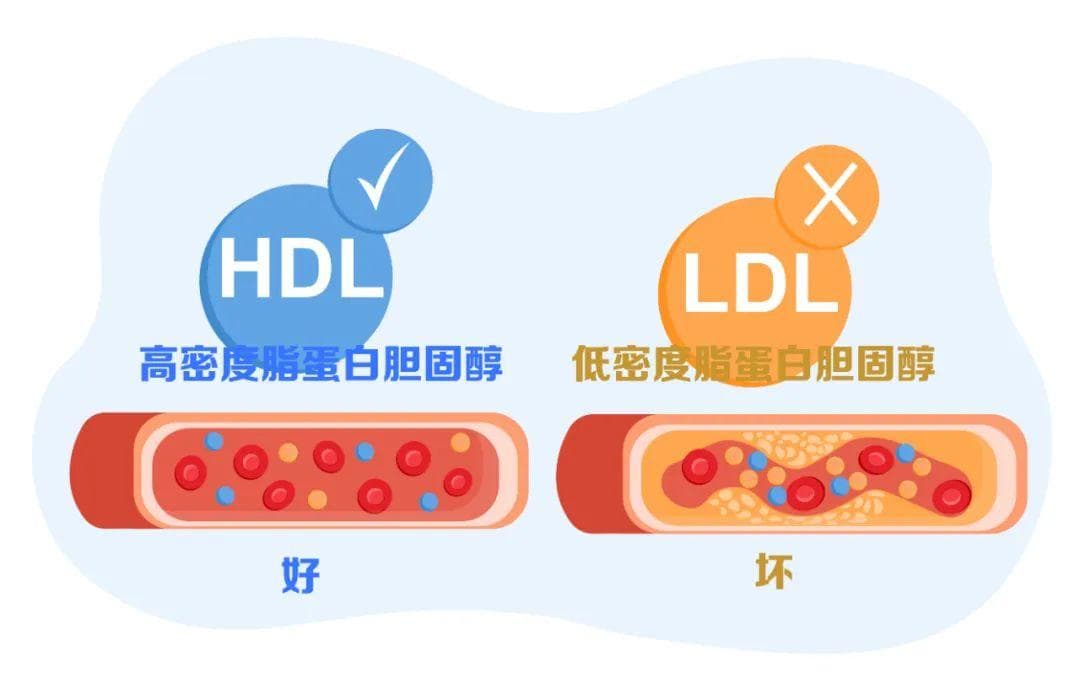 好胆固醇过高也危险