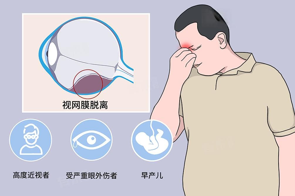 视网膜脱落术后三个月注意事项