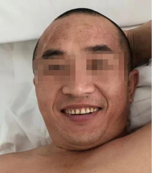 脊髓电刺激+外骨骼机器人，让截瘫患者重拾行走的希望