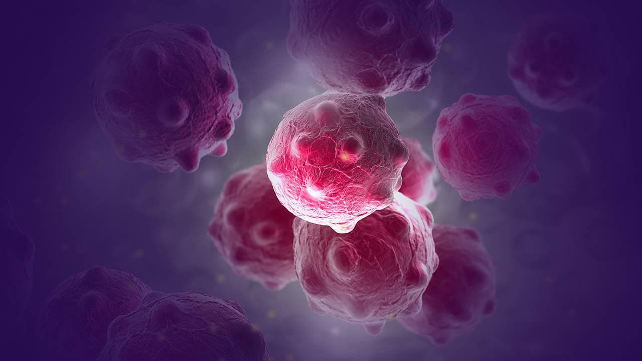 食道癌是选择放疗还是化疗好？怎样可以减轻副作用