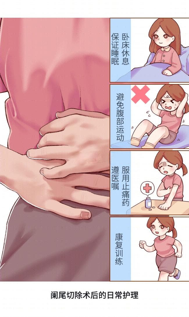 阑尾炎：症状、诊断、治疗与预防全解析