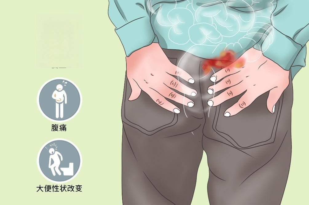 直肠癌复查多久一次，查哪几项