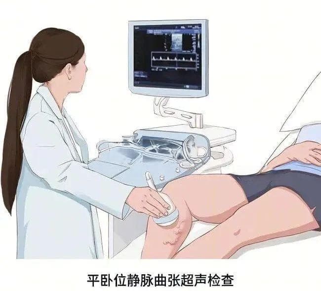 下肢深静脉血栓的影像学诊断：从超声到CTA和MRA