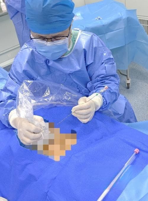 老人查出两个巨大肝囊肿 襄阳医生“以针代刀 解囊之忧”