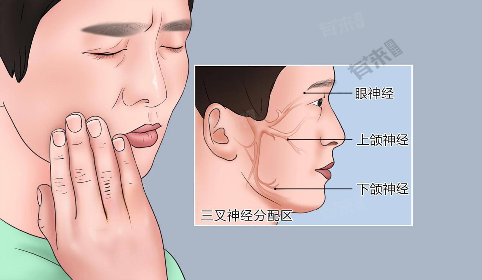 大脑神经疼怎么办？5个实用缓解方法