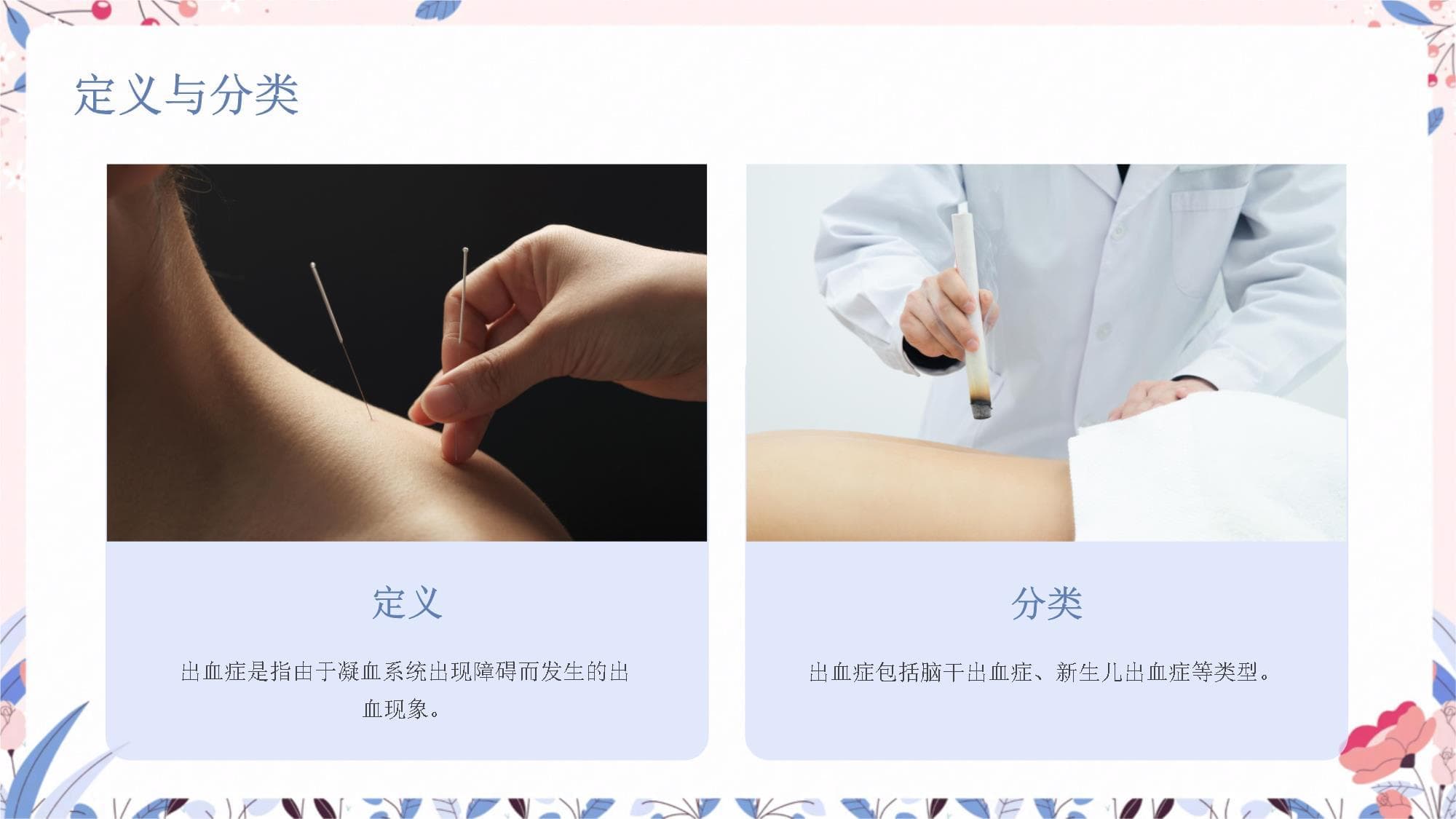 针灸治疗出血症