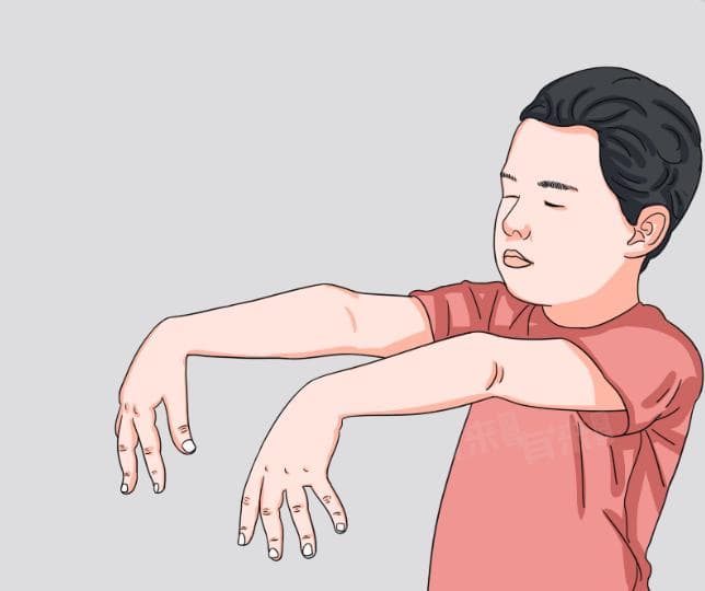 梦游的表现及治疗方法