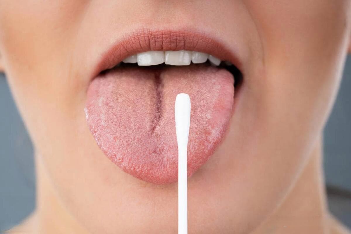 舌头有裂纹，是怎么回事？中医手把手教你把裂纹修复