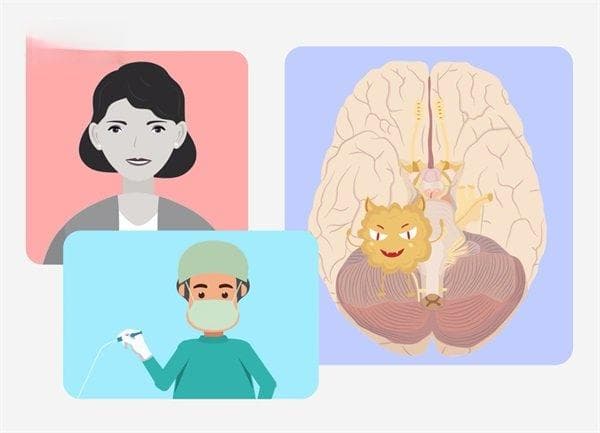 脑干胶质瘤活检方法是什么?活检成功率高吗?