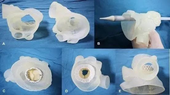 3D打印大有可为！剖析生物3D打印在医疗行业的5大技术阶段