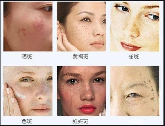 肤色的小秘密：做好防晒，你的皮肤年轻密码