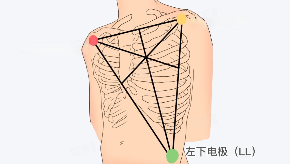 三导联的位置和颜色