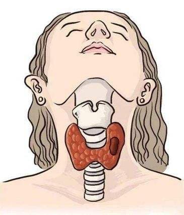 颈部肿块的分类与诊断：从淋巴结炎到甲状腺肿瘤