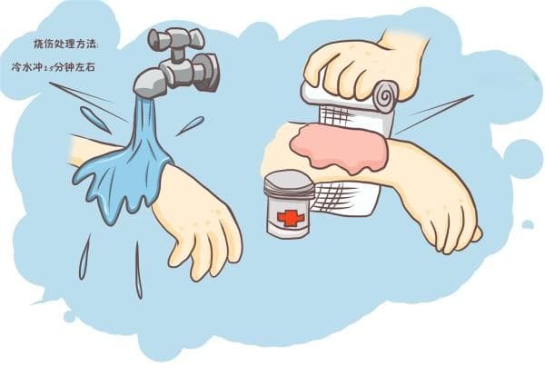 烧烫伤后怎么办？立即用流动冷水冲洗