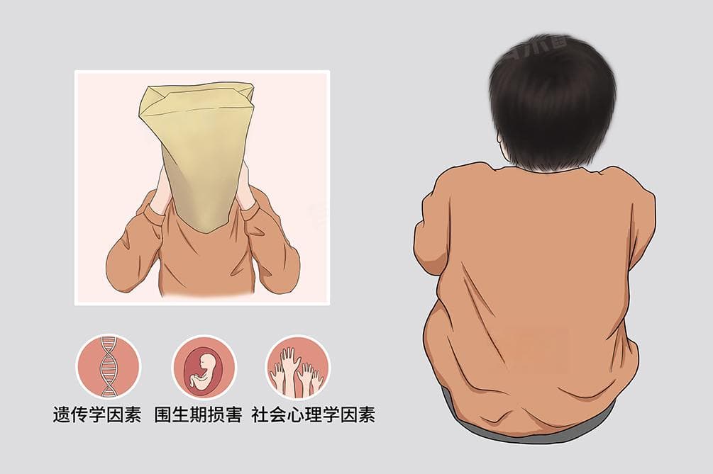儿童孤独症的定义及康复训练方法