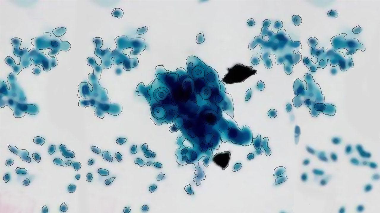 支原体是细菌还是病毒？