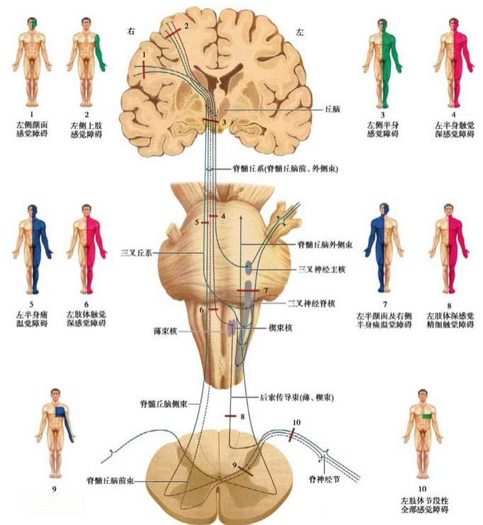 一文掌握：感觉障碍的定位诊断