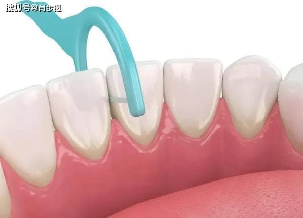 尔睦口腔科普：牙线清洁口腔比牙签更好使用，你会用吗？