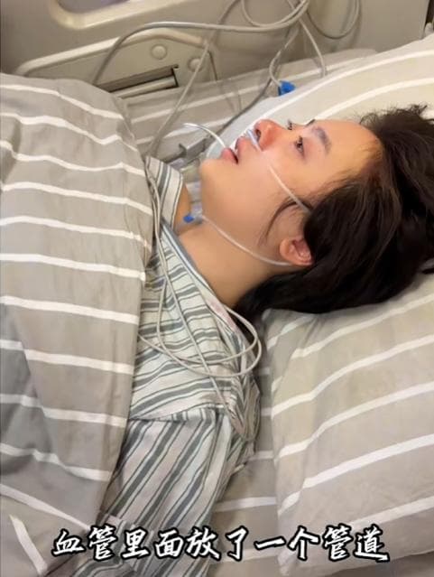 孙铱自曝脑动脉瘤：从确诊到手术，一个公众人物的健康警示