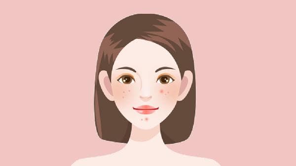 女性背上长痘痘的原因和治疗方法