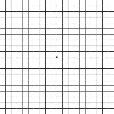 糖尿病性黄斑水肿：从自测到最新治疗方案