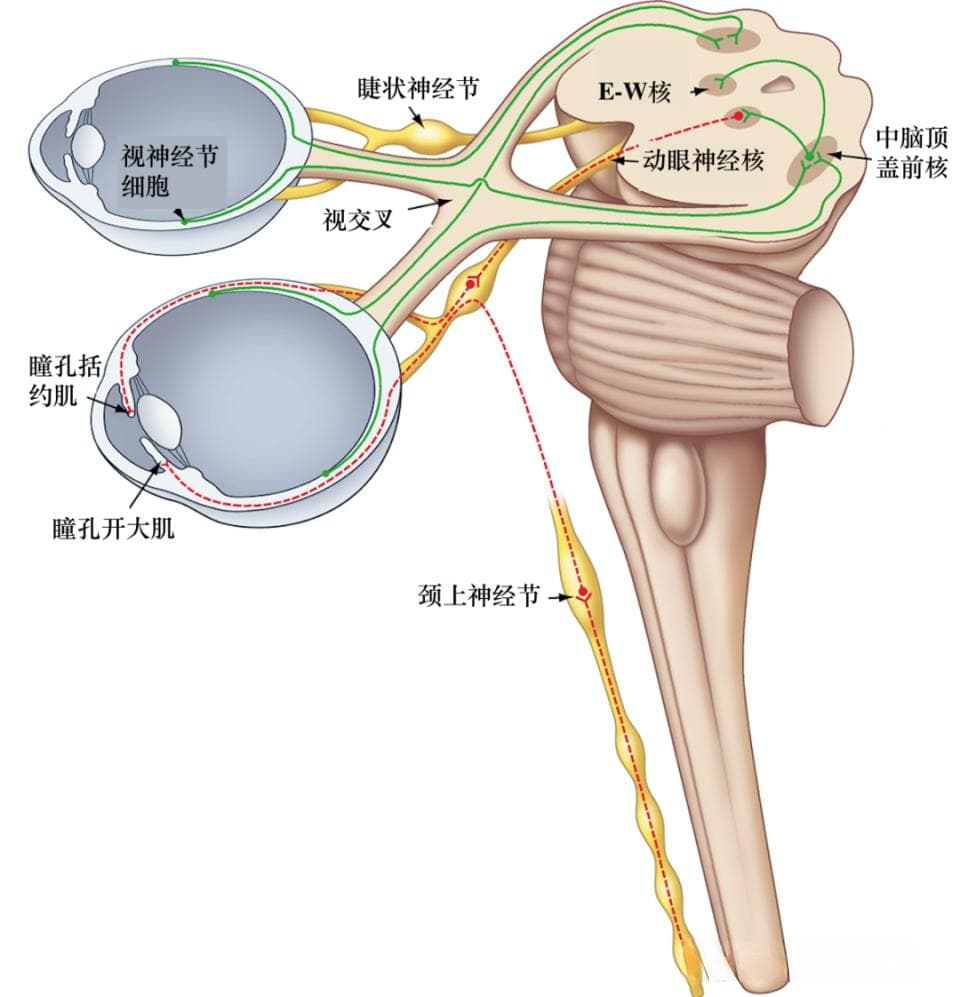 瞳孔之谜：急诊神经内科中的真实与假象