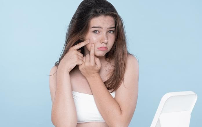 为什么“痘痘”总是喜欢找上你，到底该怎么办才好呢？