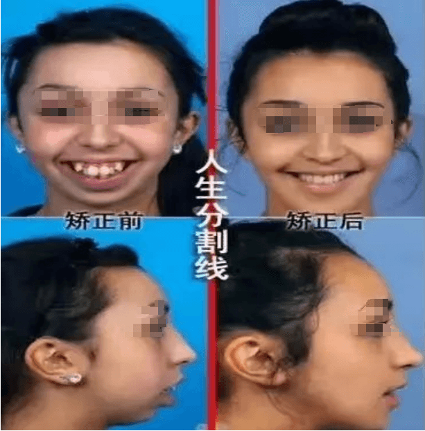 暑假整牙正当时，几点问题要注意