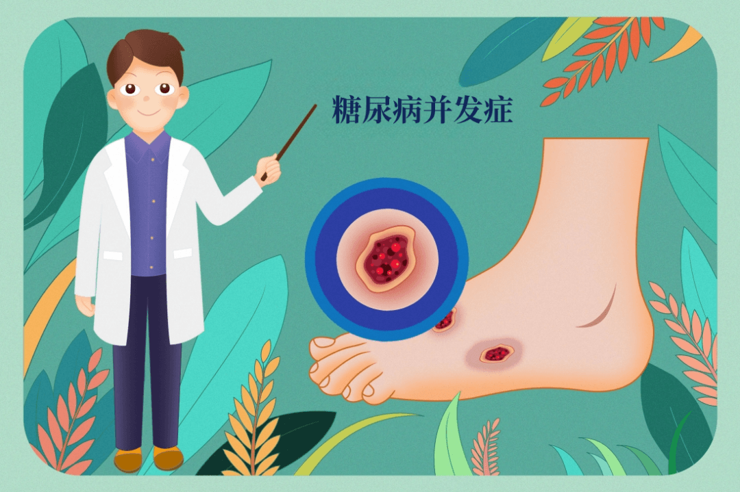 血糖高会烂脚？做“足”功课 防范糖尿病足