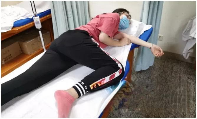 18岁少女睡出脊柱侧弯？专家提醒：这些姿势要改