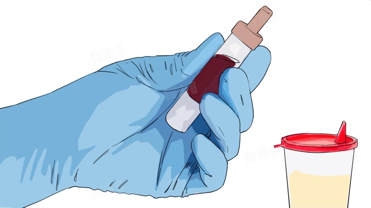 血酮体检测：定义、项目及临床应用价值