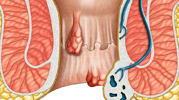 低钠盐适合什么人吃？正常人可以食用吗？