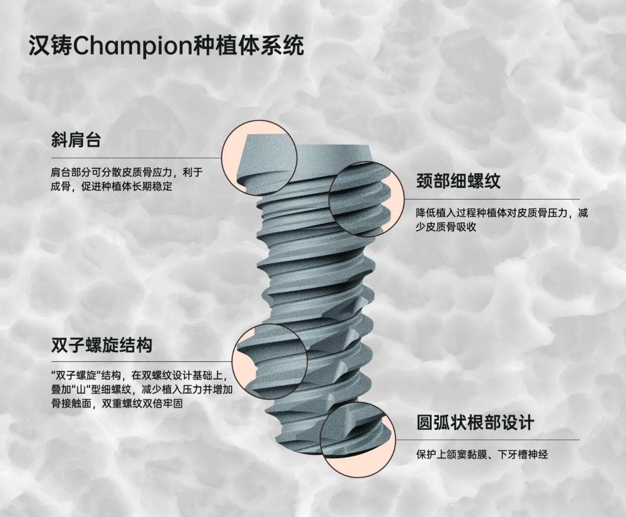 口腔种植体大揭秘：如何选到适合自己的种植体？