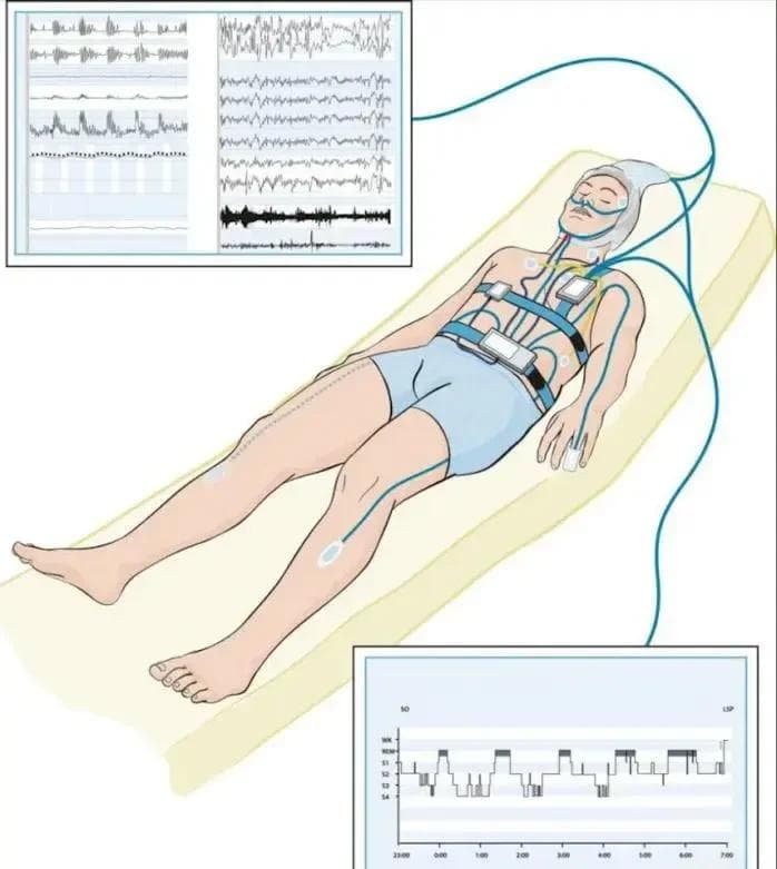 智能手环睡眠数据解读：揭开浅睡、深睡与REM的困惑幕纱