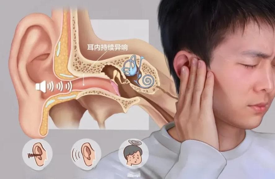 王华月医生：晚上耳鸣更严重，教你8个小方法立刻缓解？