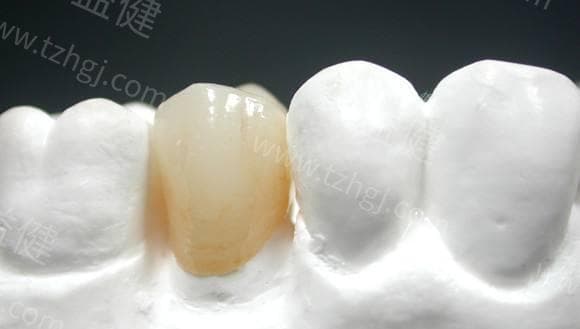 全瓷牙术后半个月牙齿疼痛怎么办？有效应对与缓解策略