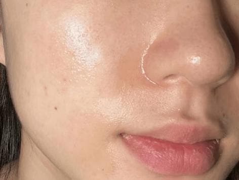 油性皮肤主要补水还是控油？