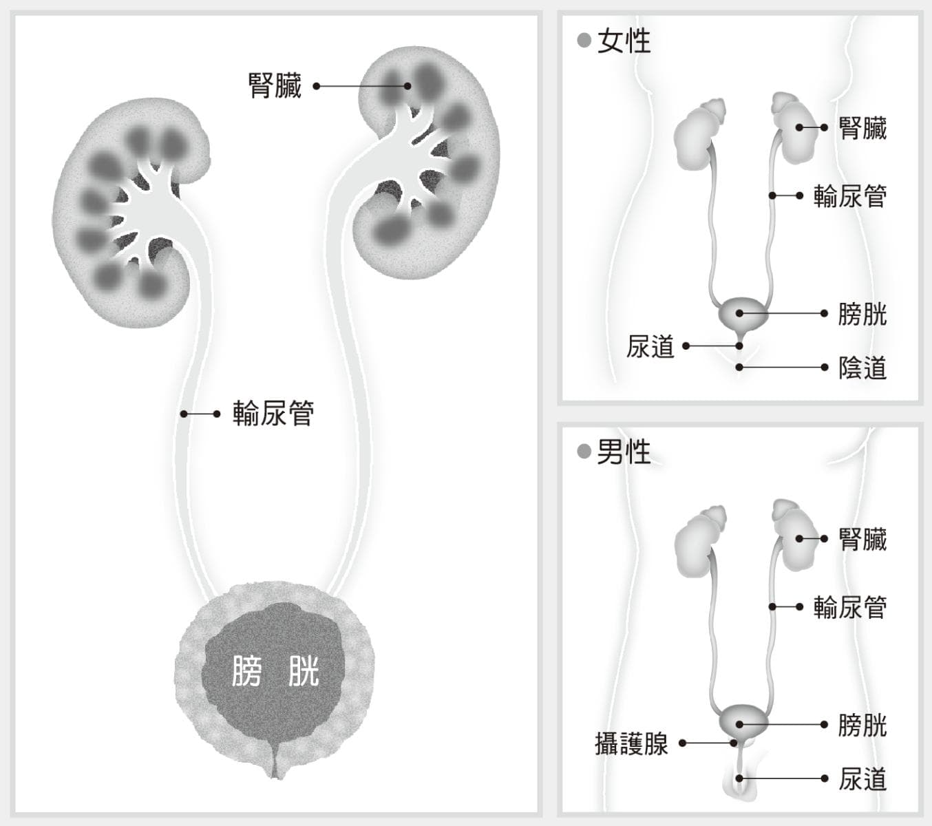 膀胱癌：从成因到治疗的全面解析