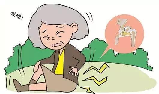 【老年特色诊疗技术】24小时内成功为86岁高龄老人实施椎管内麻醉人工股骨头置换术