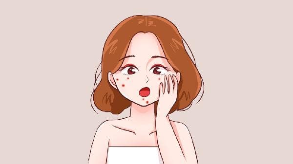 怎么改善痘痘问题